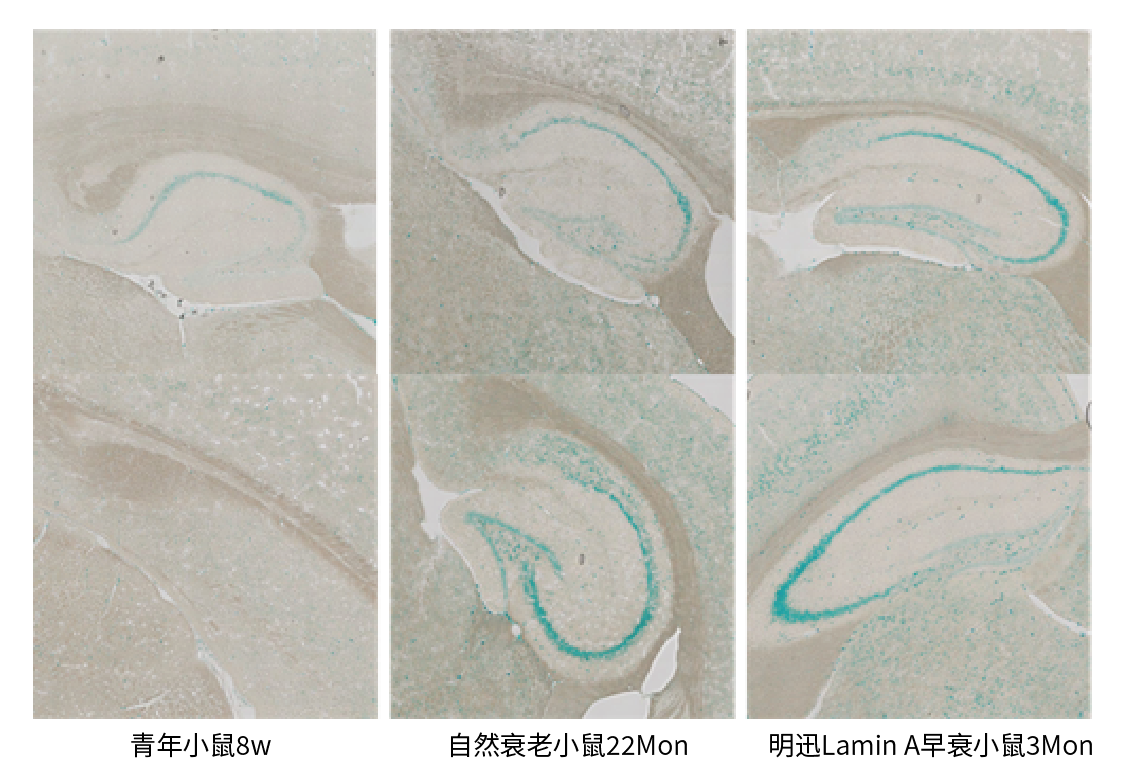 大脑海马区 SA-βgal