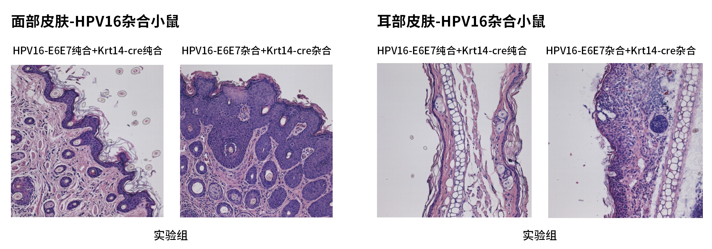 Rosa26tm1（CAG-LSL-HPV16 E6E7）/MCL纯合与杂合小鼠的表型对比